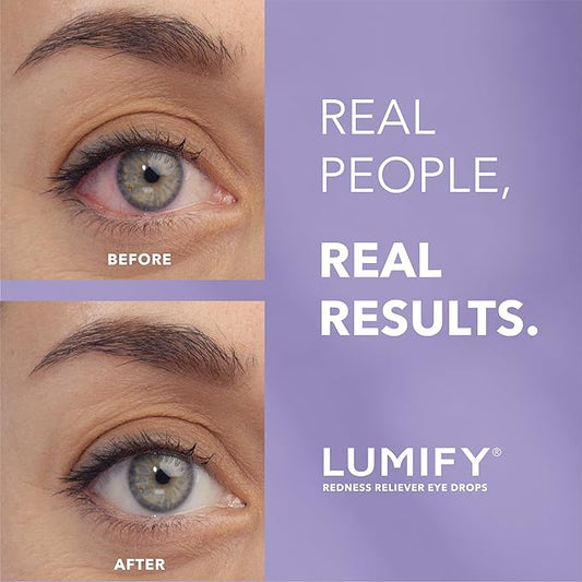 LUMIFY Redness Reliever Eye Drops