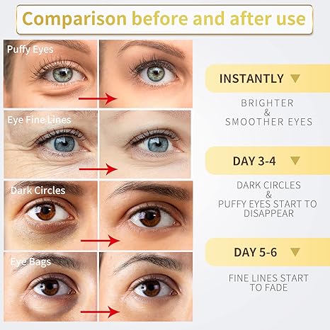 Gold Eye Mask- Puffy Eyes & Dark Circles Treatments